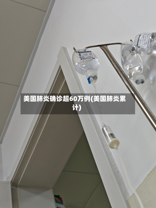 美国肺炎确诊超60万例(美国肺炎累计)-第2张图片