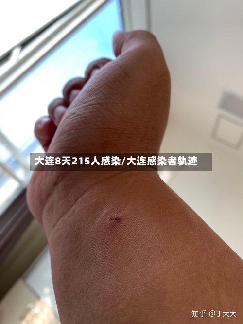 大连8天215人感染/大连感染者轨迹-第2张图片